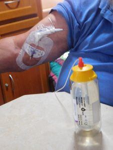 Hooked up to Chemo bottle